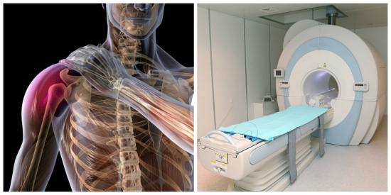 Магнитно-резонансная томография при патологиях суставов