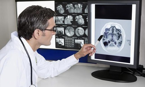 Комп'ютерна томографія голови: що визначає? » журнал здоров'я iHealth 