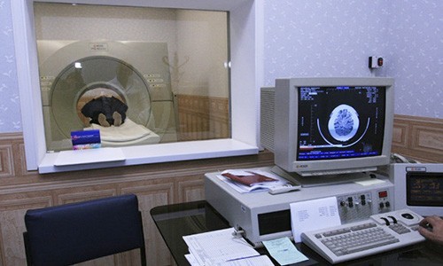 Комп'ютерна томографія голови: що визначає? » журнал здоров'я iHealth 2