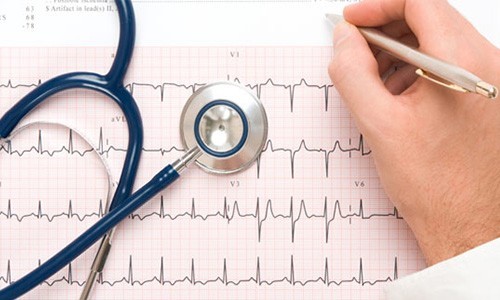 ЕКГ серця: що це таке? » журнал здоров'я iHealth 4