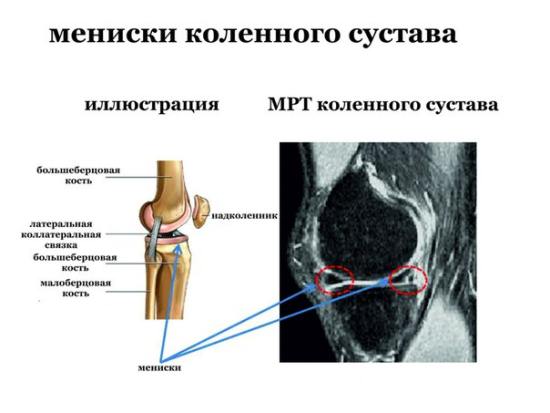 МРТ колінного суглоба: що показує, як роблять? » журнал здоров'я iHealth 1
