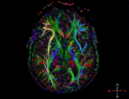 Як проходить МРТ головного мозку, скільки триває? » журнал здоров'я iHealth 1