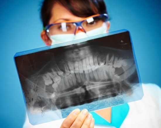 Панорамна рентгенографія щелеп (зубів): показання, проведення, результати » журнал здоров'я iHealth 2