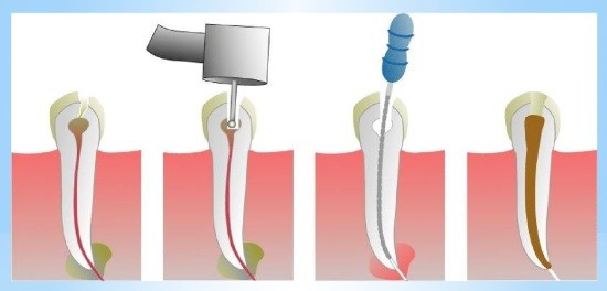 Тривимірне (3D) рентгенологічне дослідження зубів » журнал здоров'я iHealth 2