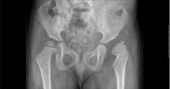 Рентген (рентгенографія) кісток тазу: підготовка, проведення, результати » журнал здоров'я iHealth 3