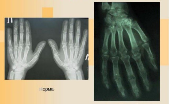 Рентген суглобів: показання, підготовка, результати » журнал здоров'я iHealth 4