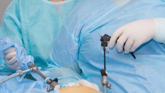 Лапароскопія – що це за операція, як роблять, плюси і мінуси » журнал здоров'я iHealth 4