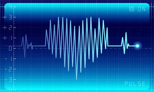 Нарушения сердечного ритма ЭКГ