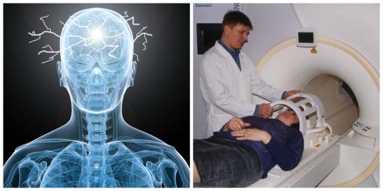Проведение магнитно-резонансной томографии пациентке, страдающей эпилепсией