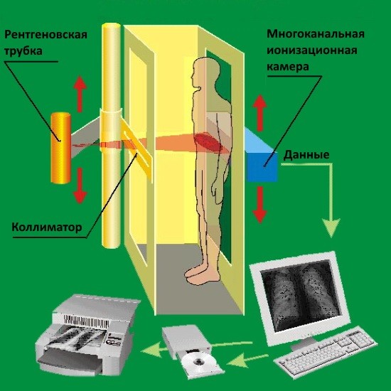 Принцип работы рентгеновского оборудования