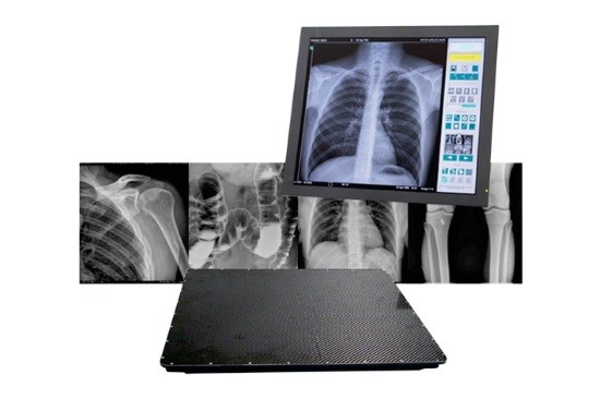 Современные аппараты позволяют делать запись рентгенограммы в цифровом виде