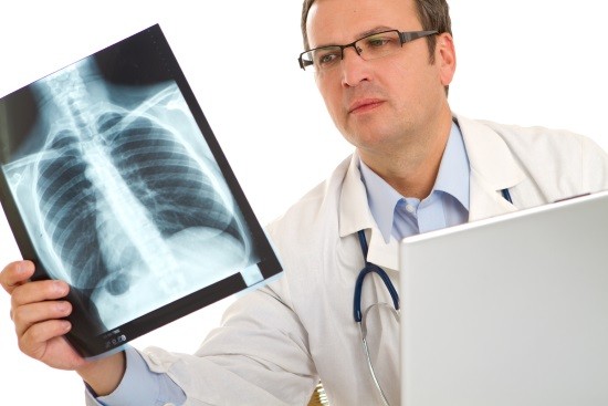 Врач-рентгенолог изучает снимок легкиих