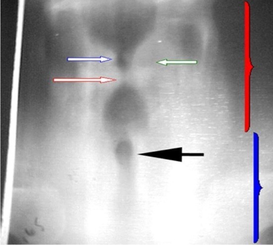 Рентгенологическая диагностика заболеваний трахеи