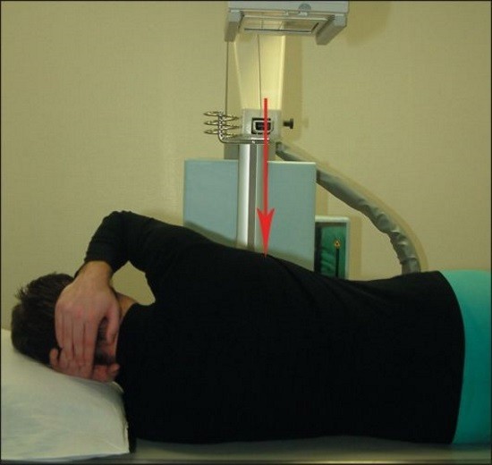 Методика проведения рентгенографии грудного отдела позвоночника