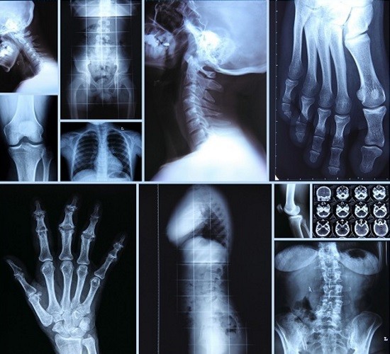 Современные цифровые рентген-аппараты несут меньшую лучевую нагрузку на обследуемого