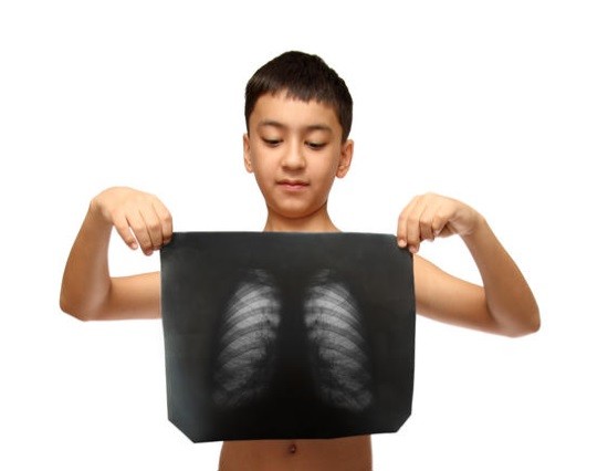 Рентгенография органов грудной клетки ребенку