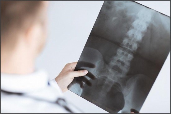 Рентгенограмма пояснично-крестцового отдела позвоночника