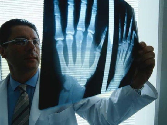 Ревматолог оценивает рентгеновский снимок