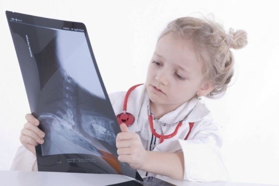Девочка рассматривает рентгеновский снимок