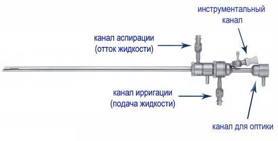 Составные части гистерорезектоскопа