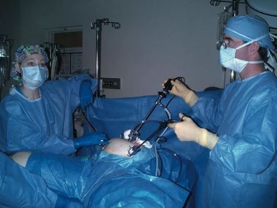 Лапароскопическая операция