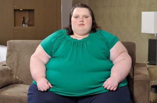 Женщина с ожирением