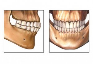 Рентгенологическое исследование верхней и нижней челюсти
