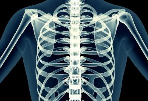 Рентген-исследование ребер, как оптимальный метод диагностики