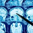 Результат МРТ головного мозга: норма и патология