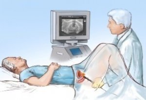 Возможности ультразвукового сканирования в выявлении патологии тазовых органов у мужчин