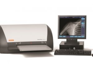 Как отсканировать и перевести рентгеновский снимок в цифровой формат