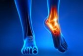 Особенности проведения УЗИ суставов ног