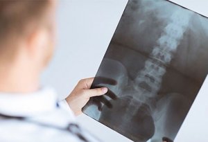 Рентген позвоночника: основа современной диагностики поражений опорно-двигательного аппарата