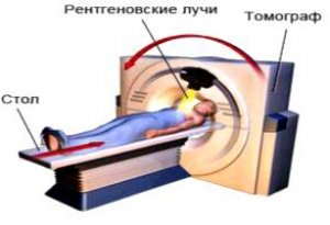 Принцип работы и возможности компьютерного томографа