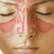 Мультиспиральная компьютерная томография придаточных пазух носа – идеальный метод выявления хронических воспалительных заболеваний
