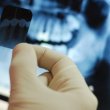 Рентген-исследование зубов – описание метода, показания, эффективность и методика проведения